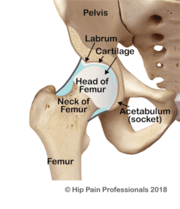 Condition-Pages_Acetabular-Dysplasia_Fig3_Type-2-258x300